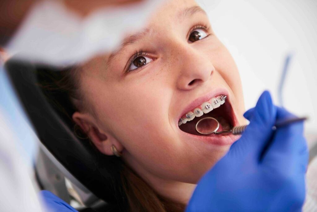 Apparecchio dentale bambini